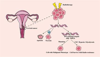 Recent progress of the tumor microenvironmental metabolism in cervical cancer radioresistance